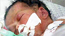 폭격·휴전 속 희생자 급증…'기적의아기' 출생