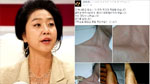 김부선 "나도 폭행 당했다"…부상 사진 공개