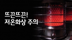 '핫팩' 저온화상 주의
