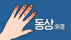 '동상', 물에 담가라!