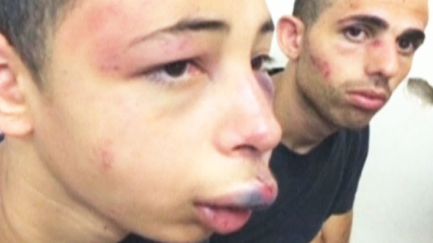 이스라엘 경찰, '팔' 소년 구타 동영상 '파문'...'중동 화약고' 긴장↑