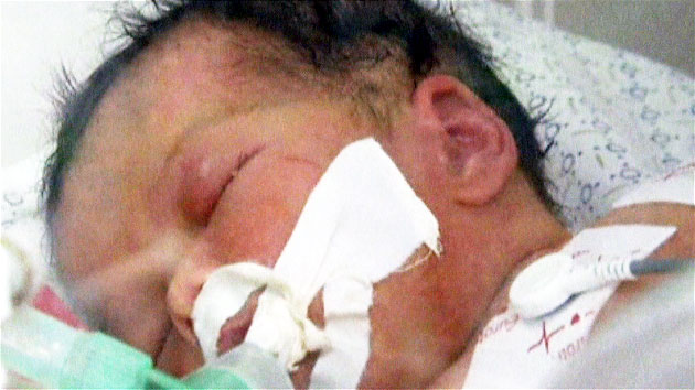 폭격·휴전 속 희생자 급증...'기적의 아기' 출생