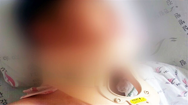 "인상 썼다며 후임 폭행"...뇌손상 의심