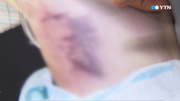 "윤 일병 고의 살해 가능성"...국방부 "살인죄 적용해야"