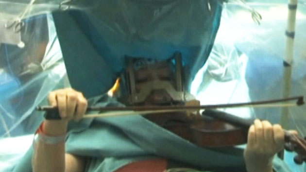 뇌 수술 중 바이올린 연주...다시 꾸는 '연주자의 꿈'