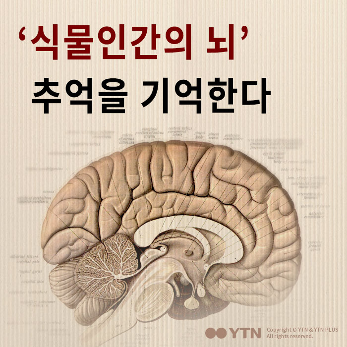 [한컷뉴스] '식물인간의 뇌' 추억을 기억한다