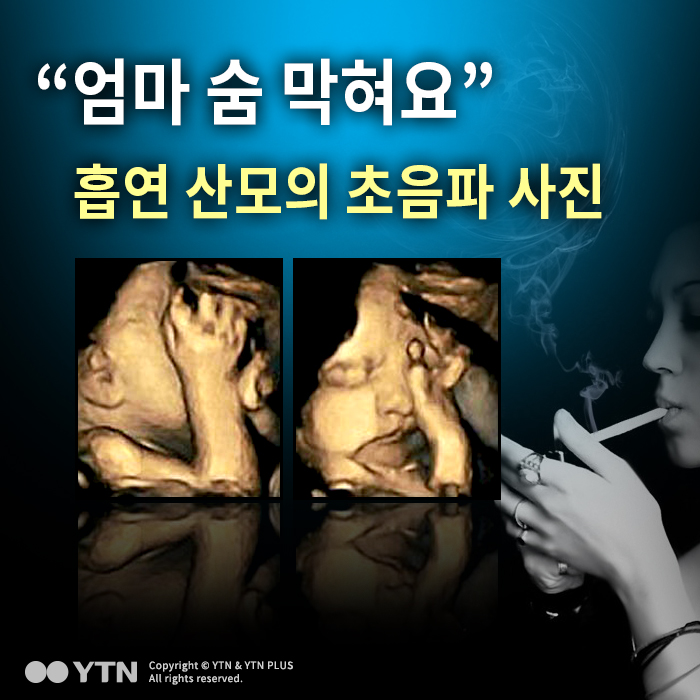 [한컷뉴스] "엄마 숨 막혀요" 흡연 산모의 초음파 사진