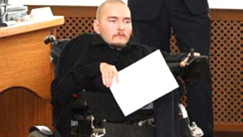 러 30세 남성, 머리 이식 수술 자원