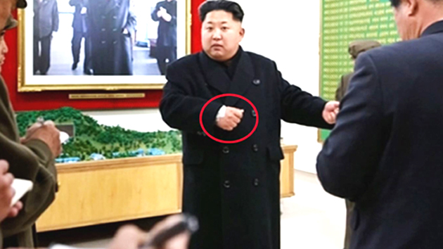 북 김정은 오른 손목 부상 포착...거즈 붙여