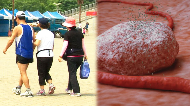 피로물질 젖산, 알고보니 암도 키운다