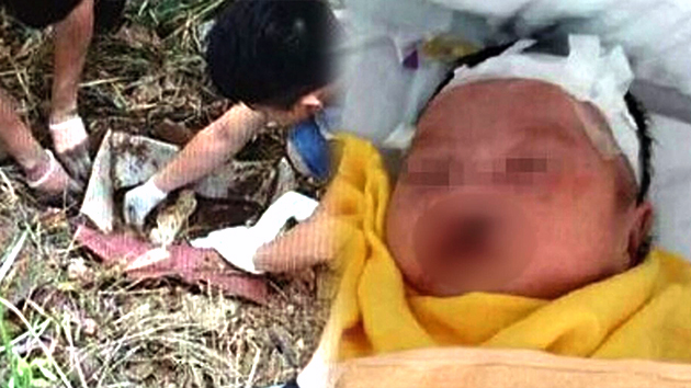 중국에서 부모가 땅에 묻어 버린 장애아 8일만에 생환