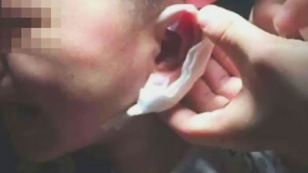 엽기적 보육교사 아동학대...귀에 구멍까지 뚫어