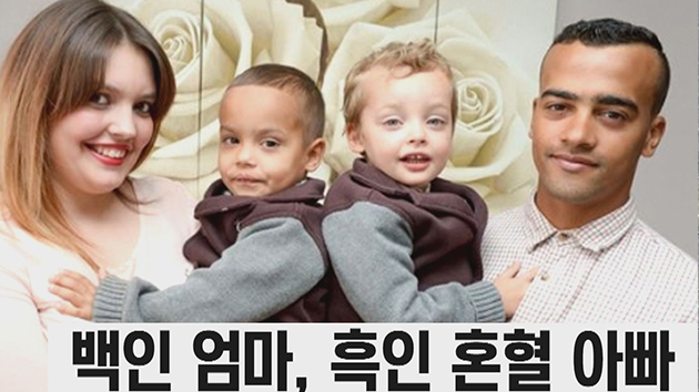 [댓글톡톡] 100만분의 1 확률로 태어난 '흑백 쌍둥이'