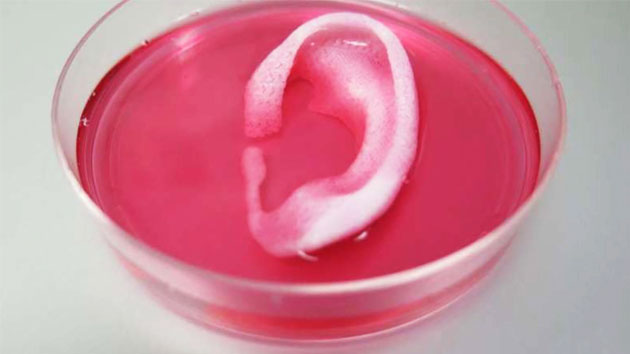 3D 프린터로 만든 귀, 생체이식 첫 성공