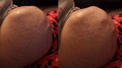 어머니 자궁 속에서 360도 '빙그르르' 도는 태아 포착
