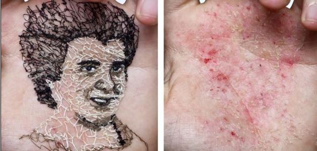 '고통스러운 예술'...바늘로 손바닥 꿰 만든 초상화 