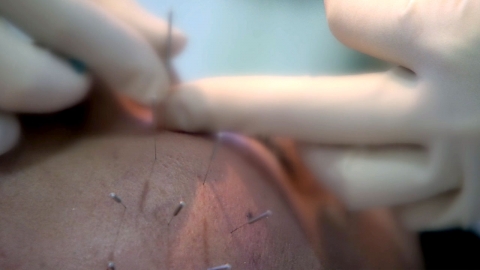 한방 치료 부작용 잇따라...가슴 성형 피해 많아