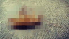 두통인 줄 알았는데...머릿속 '이것' 때문이었어?