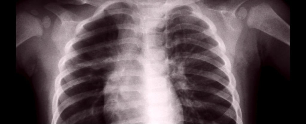 숨 쉬는 폐로 '피'도 만들 수 있다?