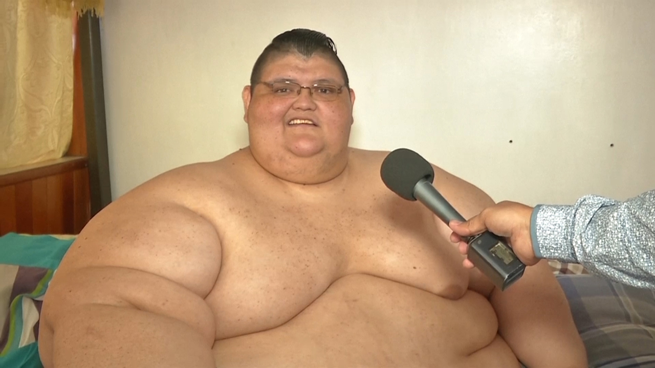 세계에서 가장 뚱뚱한 595㎏ 멕시코 男, 수술 위해 175㎏ 감량