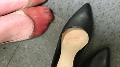 이 사람의 발 사진이 분노를 일으키는 이유