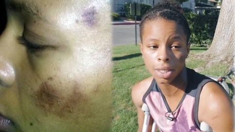 19세 흑인 소녀 경찰에게 무차별 폭행당해