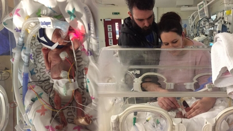 360g 미숙아로 태어난 칠삭둥이의 근황