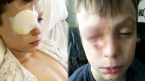 불꽃놀이 구경하던 11살 소년, 잘못 튄 화약에 실명 위기