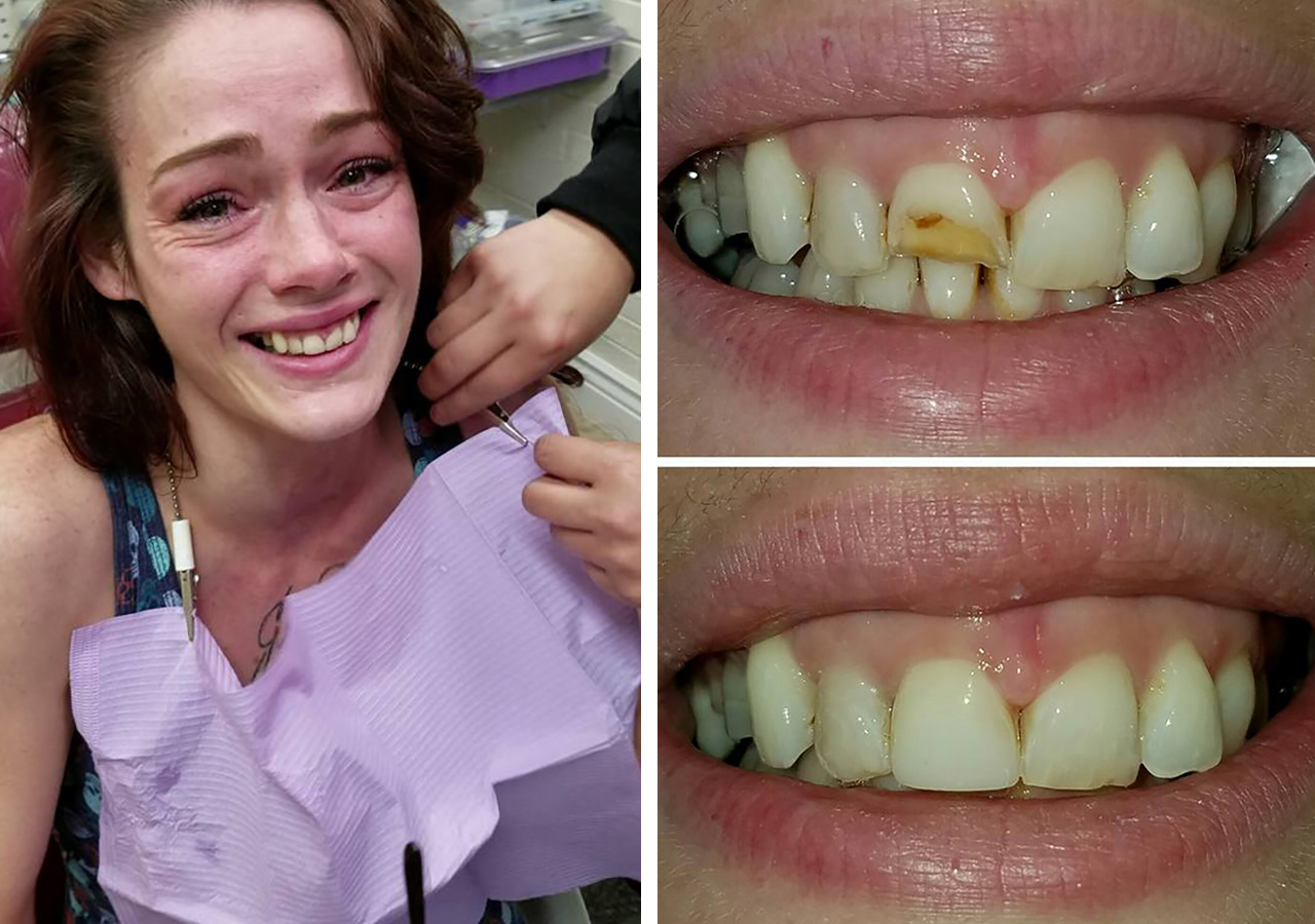 데이트 폭력 당해 부러진 여성의 치아 공짜로 치료한 의사