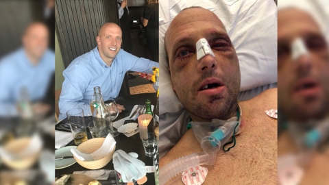 비둘기 둥지 치우다 추락해 얼굴 뼈가 산산조각이 난 남자