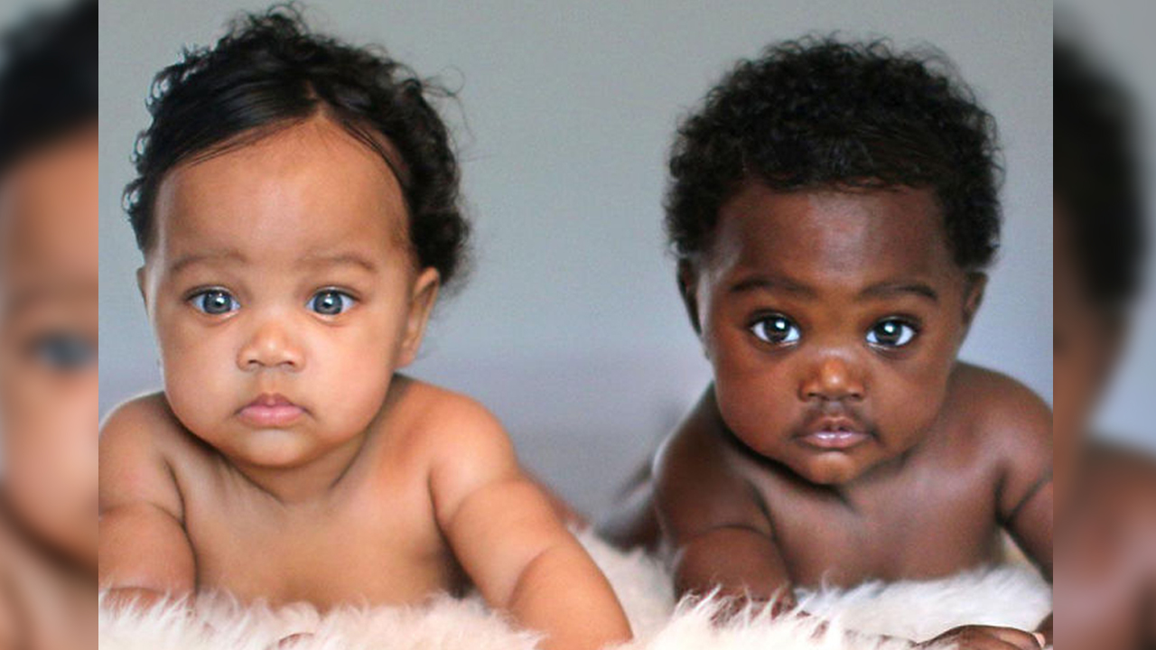 온라인 스타 된 '피부색이 다른 쌍둥이 자매'
