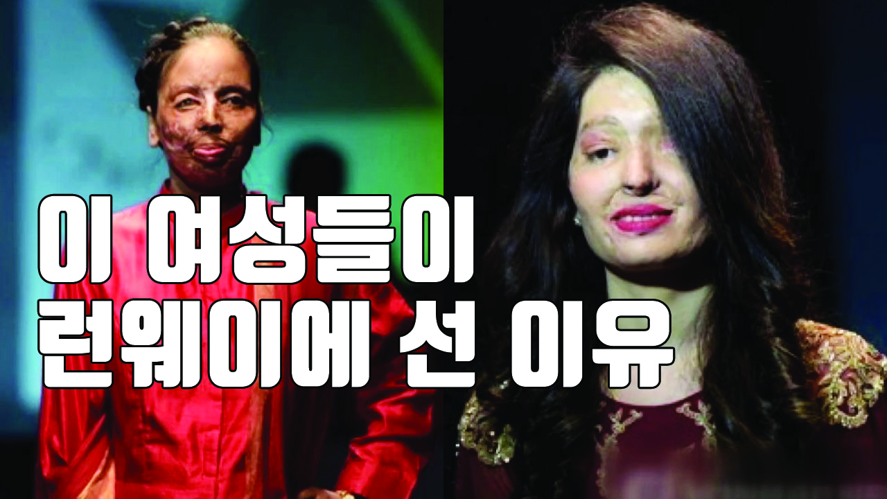 [자막뉴스] '염산 테러' 아픔 딛고 패션쇼 무대에 서다