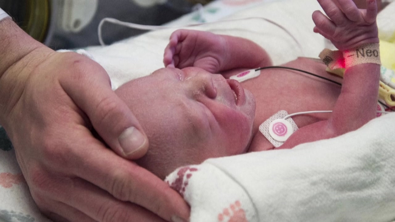 미국서 '자궁이식 출산' 성공...세계에서 두 번째