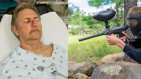 '페인트 총 주의보', 길 가던 60대 남성 총 맞아 실명