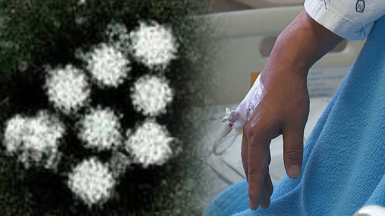노로바이러스, 2월 가장 많이 발생