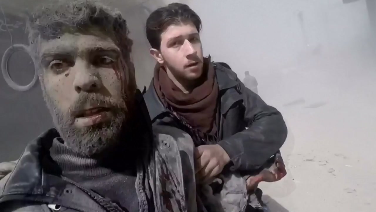 시리아군, 반군 지역 동구타 공습 70여 명 숨져