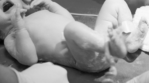조산아 탯줄 출산 1분 이후 자르면 사망 위험 감소