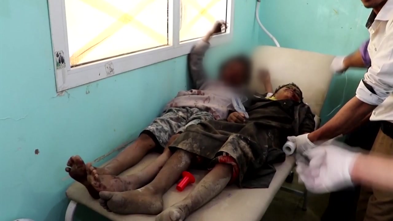 예멘 아이들 40명 목숨 앗아간 폭탄은 '미국산'