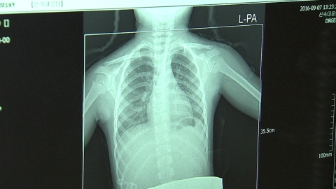 치료 거부하고 행방불명 결핵 환자, 전국에 113명