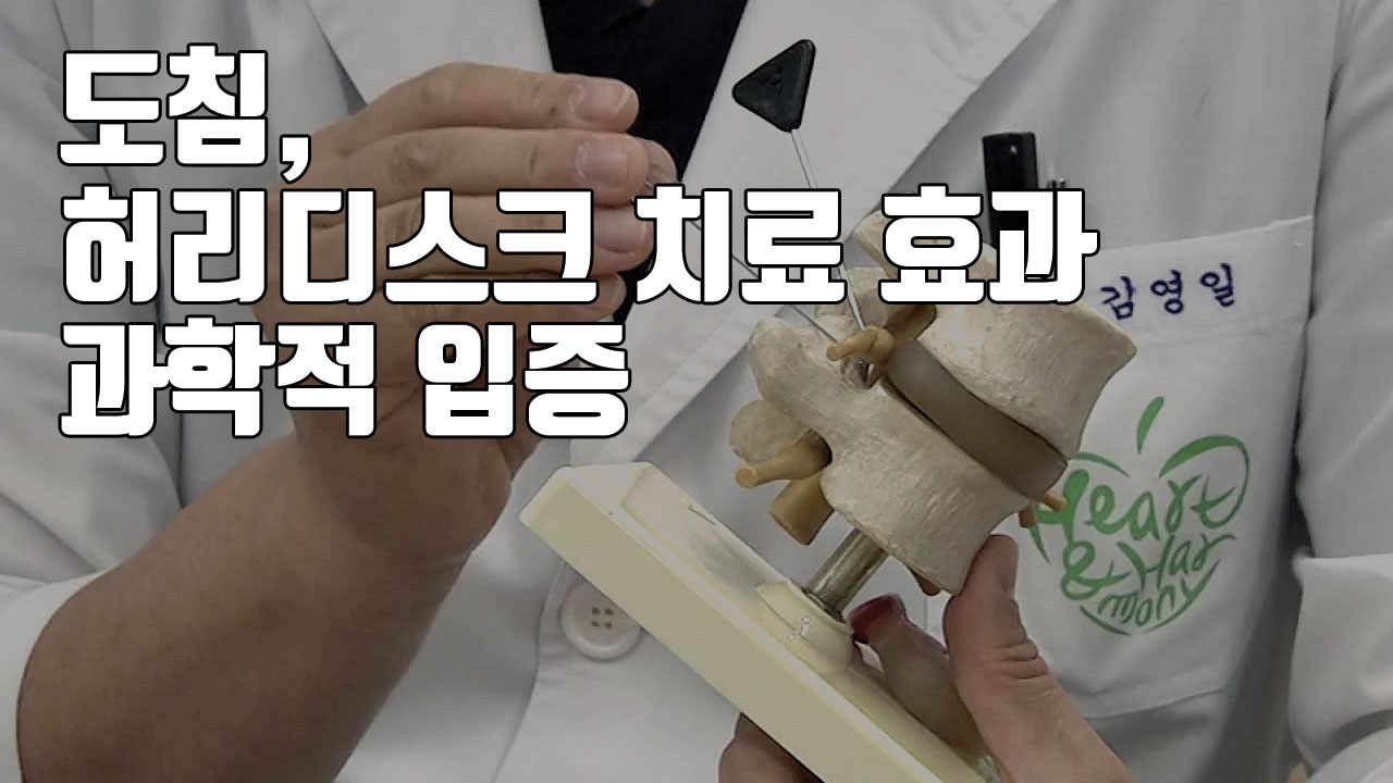 [자막뉴스] 도침, '허리디스크 치료 효과' 과학적 입증