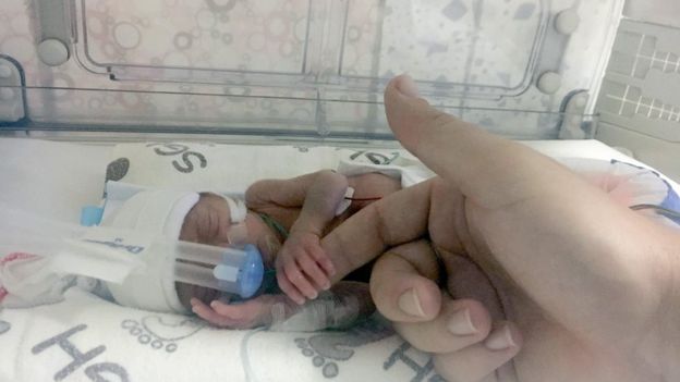 싱가포르서 출산한 커플, 여행자보험 적용안 돼 병원비만 2억
