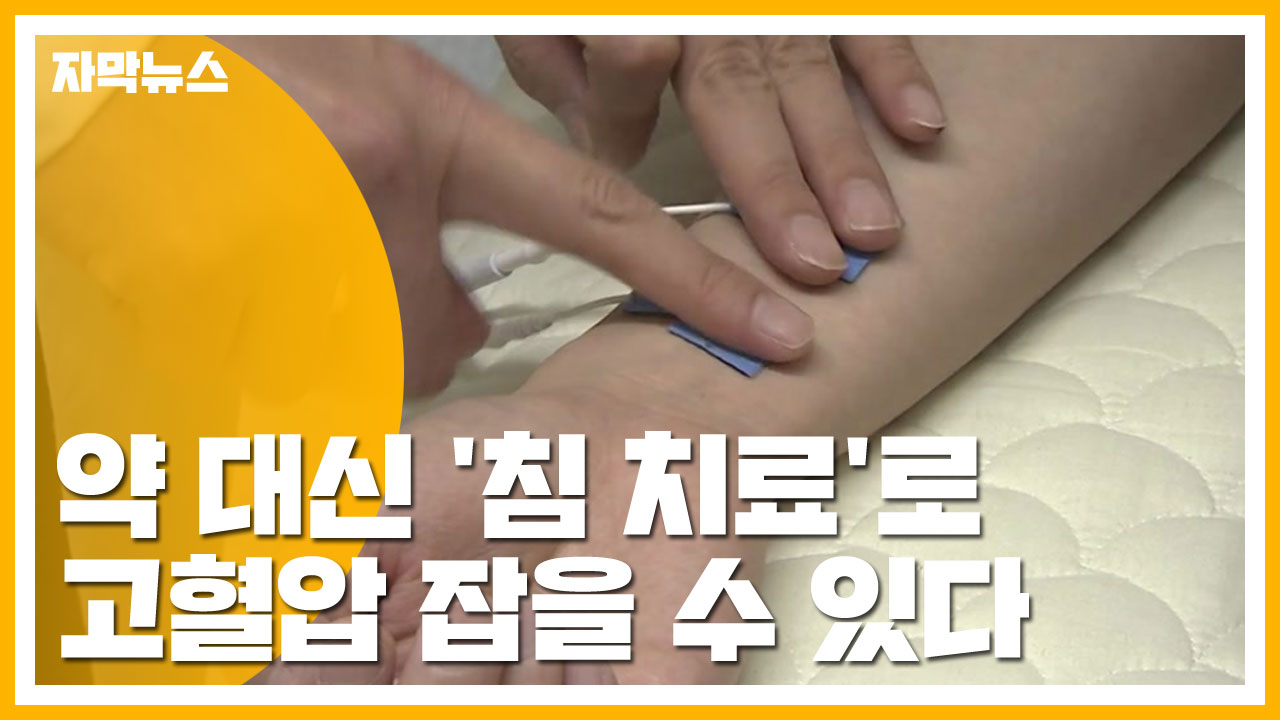 [자막뉴스] 약 대신 '침 치료'로 고혈압 잡을 수 있다
