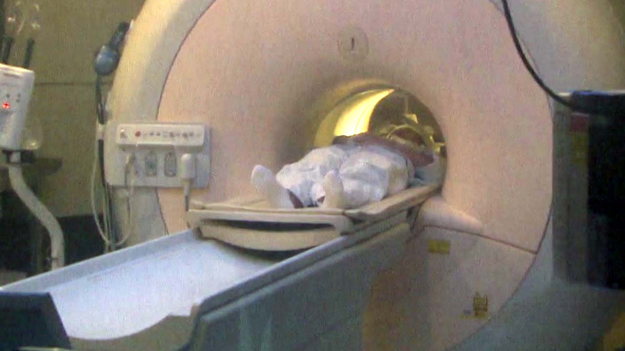 MRI·CT 없어도 치매 보험금 쉽게 받는다!