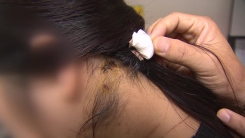 20대 여성 덮친 1m 크기 대형견...부실한 사고 대응