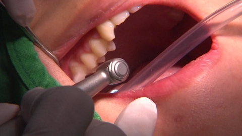 "멀쩡한 치아 뽑아냈다" 치과의사, 과잉진료한 의사 고발 청와대 청원