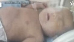 산에서 버섯 캐던 中 노인들 생매장된 신생아 발견
