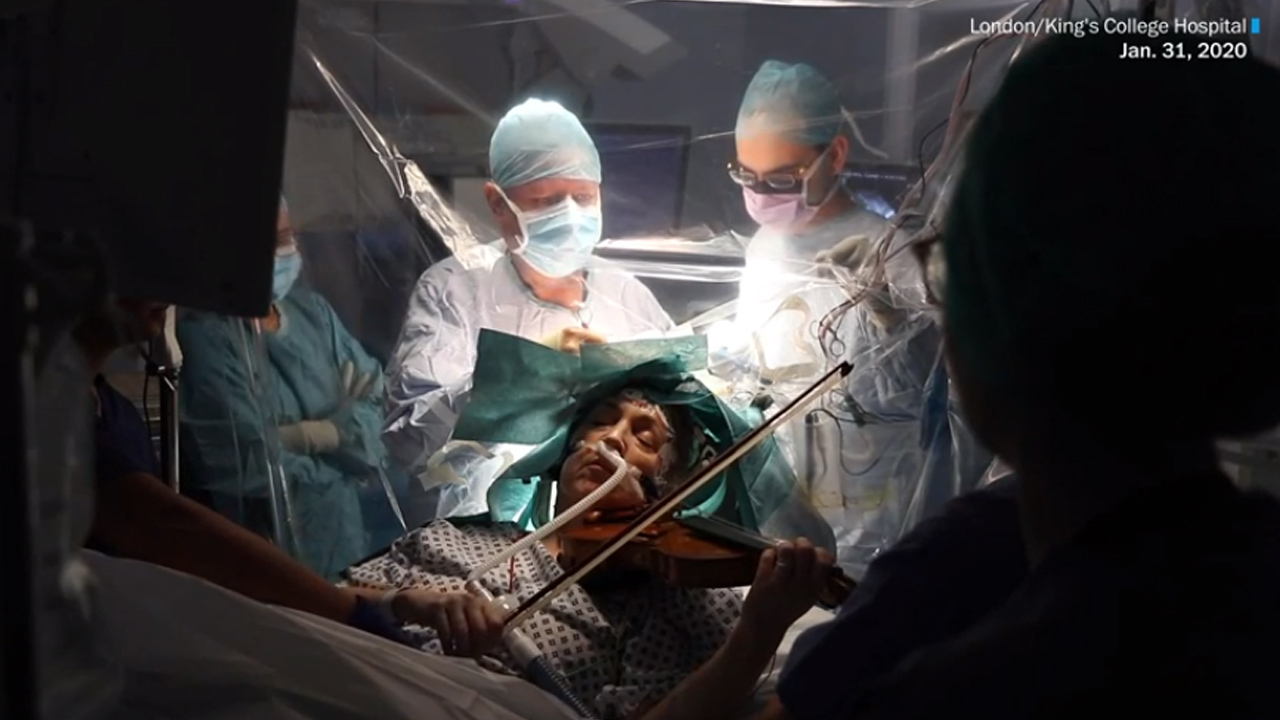뇌 종양 제거 수술 받으며 '바이올린 연주'한 음악가