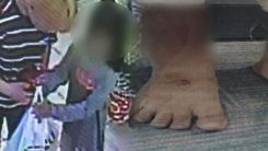 창녕 학대 부모의 만행...집안에서 목줄 묶어 가뒀다