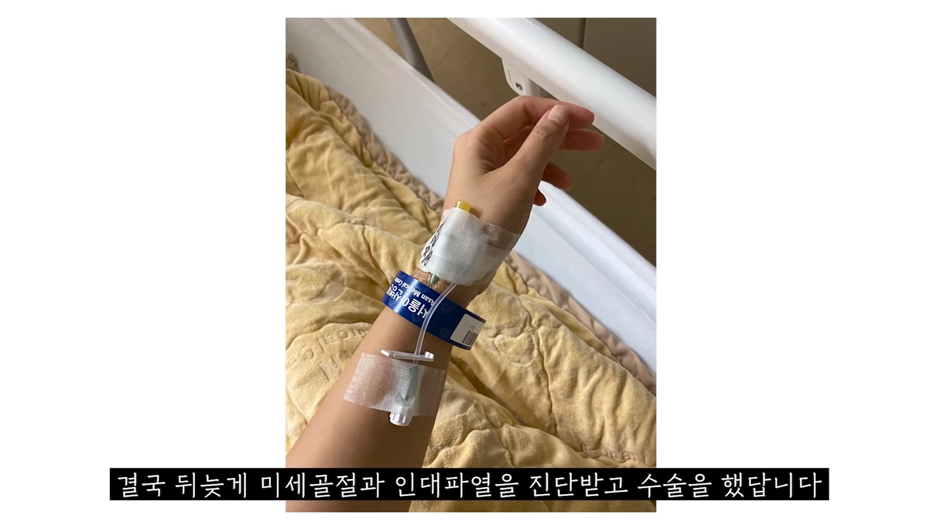 박지윤, 교통사고 후 근황 공개 “미세골절·인대파열 수술 후 회복 중”