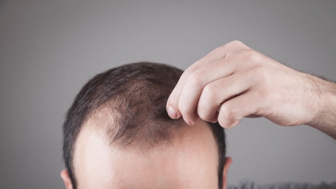 "해군사관학교 불합격 기준에 '탈모증'...시대착오적"